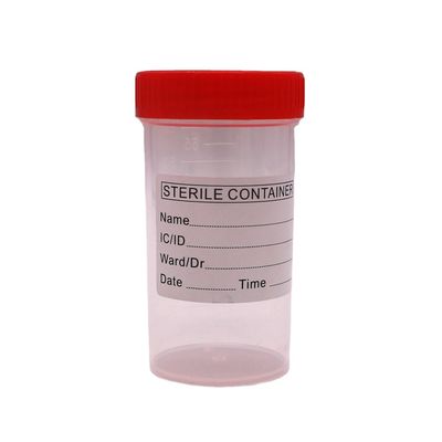 50 ml/60 ml PP-plastic stoolverzamelbeker voor monsterfles in laboratoriumbenodigdheden